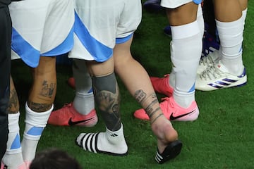 Lionel Messi's ankle was severely swollen after the international break injury.